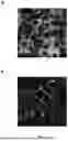 Fig. 04 - Compositions and methods for the prevention of S. aureus infection