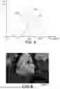 Fig. 05 - Method for grinding powders, method for coating a material, metal particles, coated material and uses of these