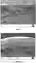 Fig. 06 - Release Capsule, Polymeric Solution, Method of Producing Capsules, Encapsulated Urea for Use in Soil Correction, Polymeric Material for Release of a Release Compound, Polymeric Controlled Release System, Method of Controlled Release, Application Composition and Soil Repairing Agent