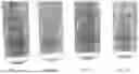 Fig. 02 - Metabolic enzyme-induced micro-nano plastic particle biodegradation method and product analysis method therefor
