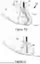 Fig. 09 - Liquid height level device