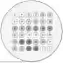 Fig. 01 - ML-ASSISTED LYME DISEASE MICROARRAY ASSAY