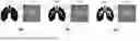 Fig. 01 - MACHINE LEARNING IN THE FIELD OF CONTRAST-ENHANCED RADIOLOGY