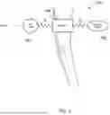 Fig. 03 - METHOD AND APPARATUS FOR DETERMINING LIMB OCCLUSION