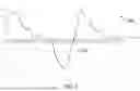Fig. 08 - METHOD AND APPARATUS FOR DETERMINING LIMB OCCLUSION