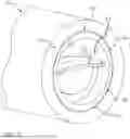 Fig. 09 - INTERMEDULLARY LENGTHENING IMPLANT WITH INTEGRATED LOAD SENSOR