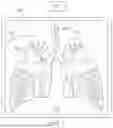 Fig. 02 - SYSTEMS AND METHODS FOR UPDATING A TARGET LOCATION USING INTRAOPERATIVE IMAGE DATA