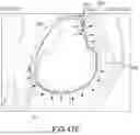 Fig. 131 - SYSTEMS AND METHODS FOR SURGICAL PLANNING OF ARTHROPLASTY PROCEDURES