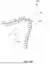 Fig. 136 - SYSTEMS AND METHODS FOR SURGICAL PLANNING OF ARTHROPLASTY PROCEDURES