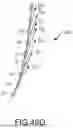 Fig. 137 - SYSTEMS AND METHODS FOR SURGICAL PLANNING OF ARTHROPLASTY PROCEDURES
