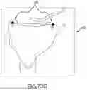 Fig. 201 - SYSTEMS AND METHODS FOR SURGICAL PLANNING OF ARTHROPLASTY PROCEDURES