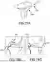 Fig. 210 - SYSTEMS AND METHODS FOR SURGICAL PLANNING OF ARTHROPLASTY PROCEDURES