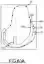 Fig. 216 - SYSTEMS AND METHODS FOR SURGICAL PLANNING OF ARTHROPLASTY PROCEDURES