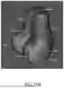 Fig. 41 - SYSTEMS AND METHODS FOR SURGICAL PLANNING OF ARTHROPLASTY PROCEDURES