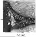 Fig. 74 - SYSTEMS AND METHODS FOR SURGICAL PLANNING OF ARTHROPLASTY PROCEDURES