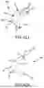 Fig. 90 - SYSTEMS AND METHODS FOR SURGICAL PLANNING OF ARTHROPLASTY PROCEDURES