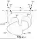 Fig. 97 - SYSTEMS AND METHODS FOR SURGICAL PLANNING OF ARTHROPLASTY PROCEDURES