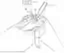 Fig. 01 - Surgical Systems And Methods For Providing Surgical Guidance With A Head-Mounted Device