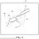 Fig. 07 - Surgical Systems And Methods For Providing Surgical Guidance With A Head-Mounted Device