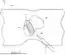 Fig. 08 - Surgical Systems And Methods For Providing Surgical Guidance With A Head-Mounted Device