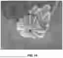 Fig. 09 - Interactive planner for repair or replacement surgery