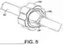 Fig. 06 - DEVICES, SYSTEMS AND METHODS FOR USER GUIDANCE IN SURGICAL NAVIGATION