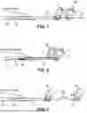 Fig. 02 - CATHETER ROBOT
