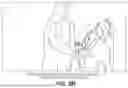 Fig. 04 - Robotic surgical systems