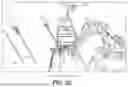 Fig. 08 - Robotic surgical systems