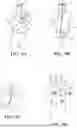 Fig. 09 - Lighting apparatus
