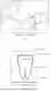 Fig. 02 - DENTAL ALIGNER