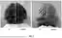 Fig. 08 - COMPOSITIONS AND METHODS FOR TREATING KERATIN FIBERS