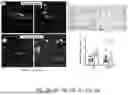 Fig. 03 - COMPOSITIONS AND METHODS USED FOR RETINAL ISCHEMIA OR DIABETES