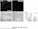 Fig. 04 - COMPOSITIONS AND METHODS USED FOR RETINAL ISCHEMIA OR DIABETES