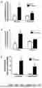 Fig. 12 - COMPOSITIONS AND METHODS USED FOR RETINAL ISCHEMIA OR DIABETES