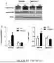 Fig. 13 - COMPOSITIONS AND METHODS USED FOR RETINAL ISCHEMIA OR DIABETES