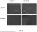 Fig. 16 - COMPOSITIONS AND METHODS USED FOR RETINAL ISCHEMIA OR DIABETES