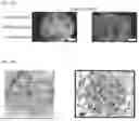 Fig. 07 - TOMATO-DERIVED SIJUL GENE REGULATING PHLOEM DEVELOPMENT AND USE THEREOF