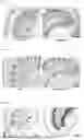 Fig. 20 - TOMATO-DERIVED SIJUL GENE REGULATING PHLOEM DEVELOPMENT AND USE THEREOF
