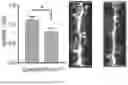 Fig. 12 - TARGETING CAP-DEPENDENT TRANSLATION TO REDUCE SEIZURES IN MTOR DISORDERS