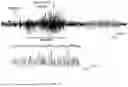 Fig. 26 - TARGETING CAP-DEPENDENT TRANSLATION TO REDUCE SEIZURES IN MTOR DISORDERS