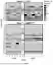 Fig. 30 - TARGETING CAP-DEPENDENT TRANSLATION TO REDUCE SEIZURES IN MTOR DISORDERS