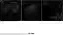 Fig. 63 - ANTI-INFLAMMATORY CYTOKINES AND METHODS OF USE