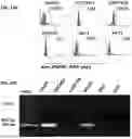 Fig. 28 - METHODS AND COMPOSITIONS OF A FOLLICLE STIMULATING HORMONE RECEPTOR IMMUNORECEPTOR OR CHIMERIC ANTIGEN RECEPTOR