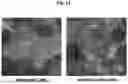 Fig. 32 - METHODS AND COMPOSITIONS OF A FOLLICLE STIMULATING HORMONE RECEPTOR IMMUNORECEPTOR OR CHIMERIC ANTIGEN RECEPTOR