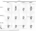 Fig. 85 - METHODS OF OBTAINING TUMOR-SPECIFIC T CELL RECEPTORS