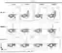 Fig. 87 - METHODS OF OBTAINING TUMOR-SPECIFIC T CELL RECEPTORS