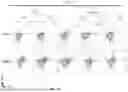 Fig. 92 - METHODS OF OBTAINING TUMOR-SPECIFIC T CELL RECEPTORS