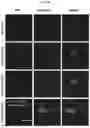 Fig. 19 - PLATELET ALPHA-GRANULES FOR DELIVERY OF MULTIPLE PROTEINS