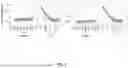 Fig. 08 - HYPERIMMUNE GLOBULIN FORMULATIONS